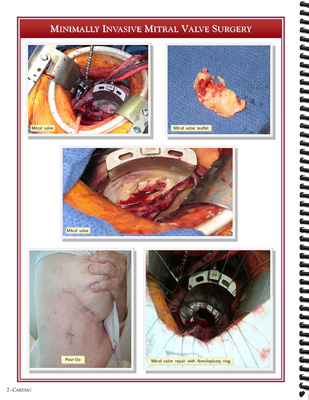 Cardiothoracic Surgeons' 
Case Studies Referral Booklet