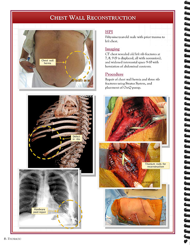 Cardiothoracic Surgeons' 
Case Studies Referral Booklet